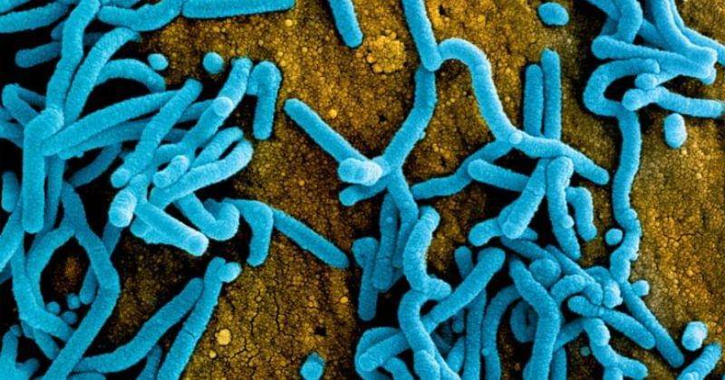 Pinterest.com/Azeeali